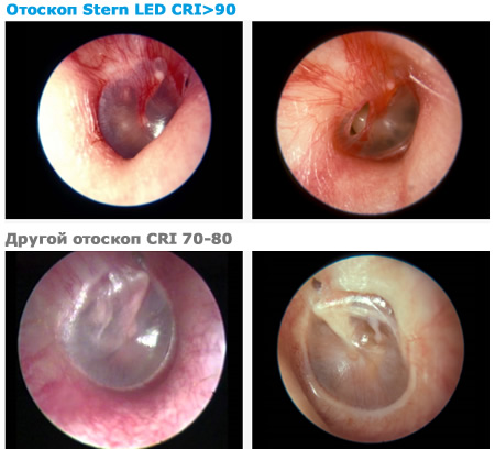 Цветопередача отоскопа