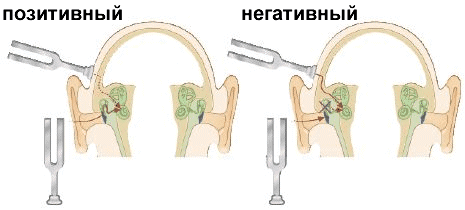 Тест Ренне 1